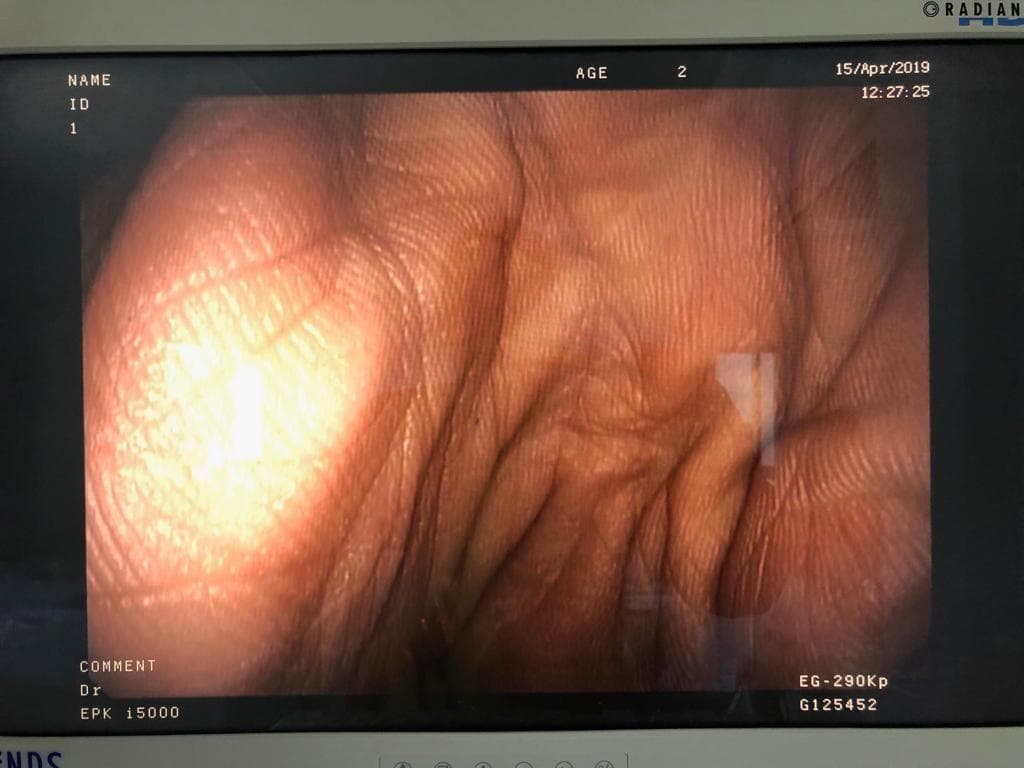 PENTAX EG-290Kp Flexible Video Gastroscope for Upper GI Endoscopy thumbnail 4