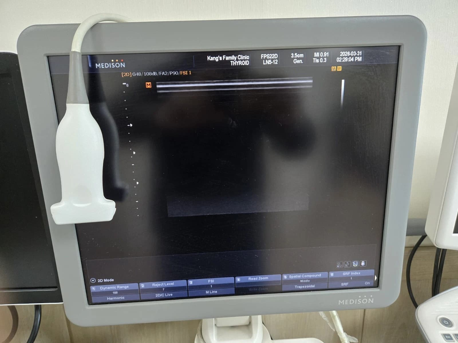Samsung LN5-12 Linear Ultrasound Probe for SonoAce R7, X8, HS40 and MySono U6 Systems – Vascular, Small Parts and MSK Imaging