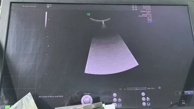 GE Voluson E8 Voluson E10 EC320 ultrasound machine repair RFM423 beamformer board) Artifact Imaging or no echo (KTZ304074 / 5729200 / KTZ304142) thumbnail 3