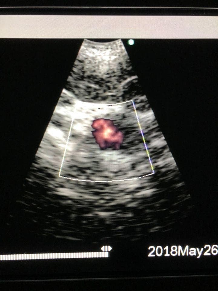 Olympus EU-C60 Endoscopic Ultrasound Processor for EBUS Procedures thumbnail 4