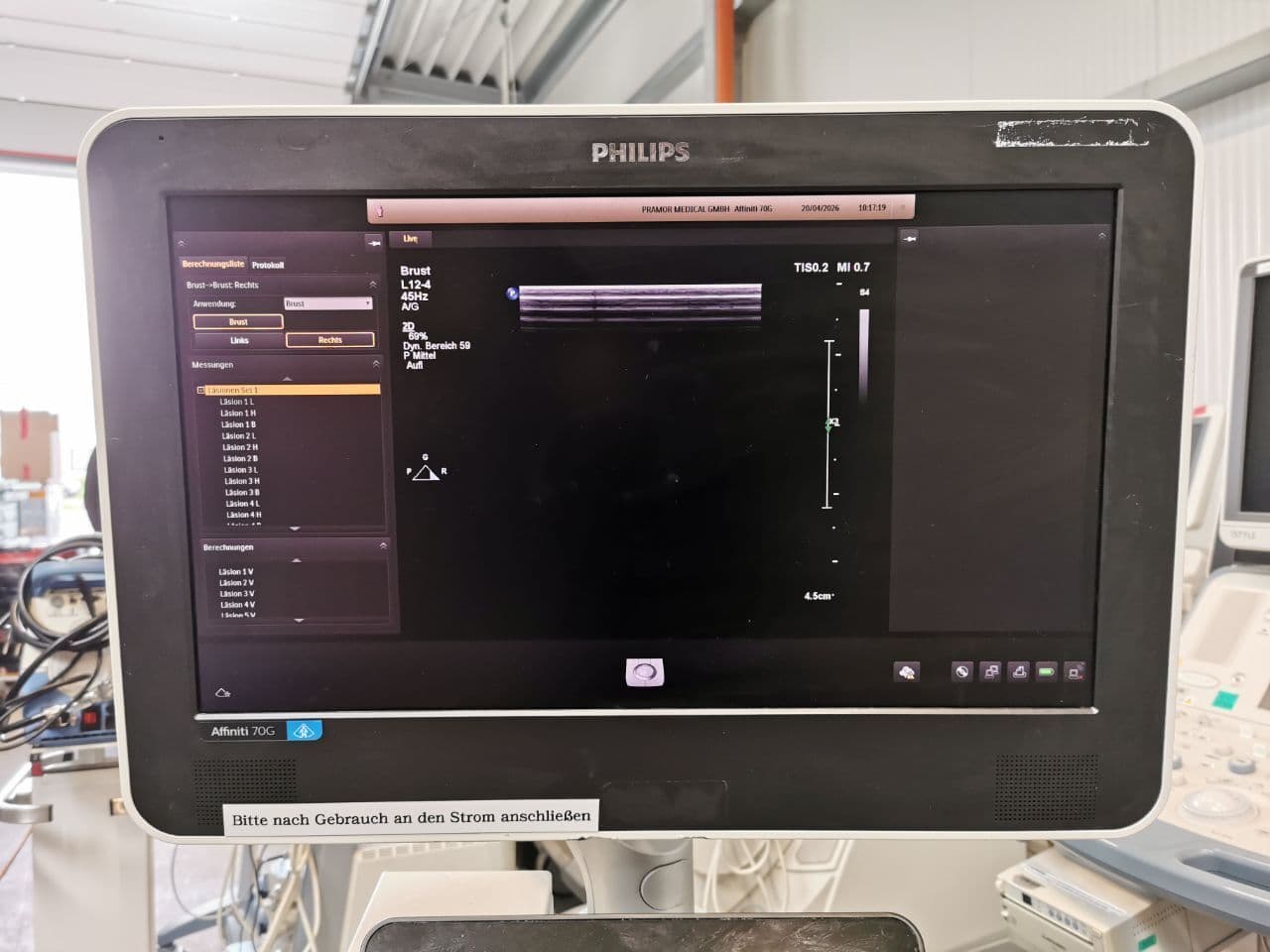 Philips L12-4 Linear Array Ultrasound Transducer thumbnail 5