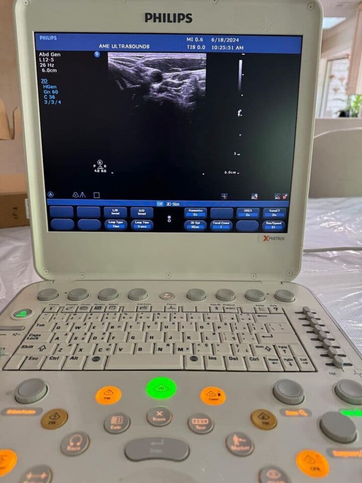 Philips CX50 Portable Cardiac Ultrasound System thumbnail 3