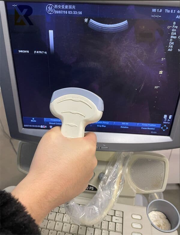 GE Logiq P5 Mobile Color Doppler Ultrasound System thumbnail 3