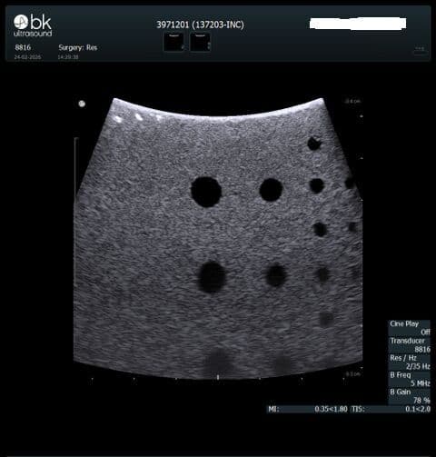 BK Medical 8816 T-Shaped Intraoperative Ultrasound Transducer thumbnail 4