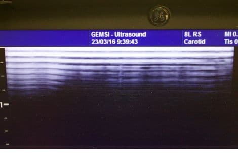 GE 8L Vascular and Small Parts Ultrasound Transducer thumbnail 4
