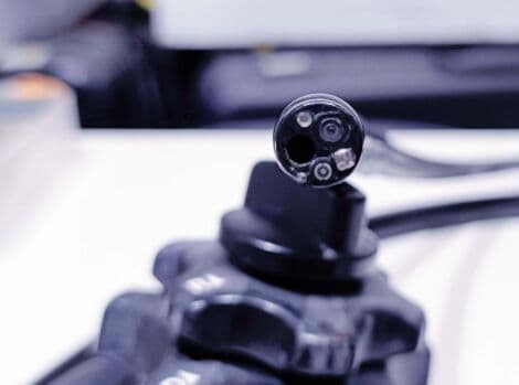 Olympus GIF-160 Video Gastroscope thumbnail 2