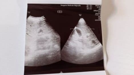 GE EM6C 4D Convex Matrix Ultrasound Transducer thumbnail 8