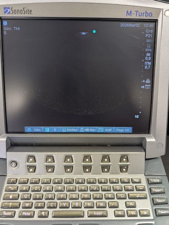 SonoSite P21x Cardiac Ultrasound Transducer thumbnail 7