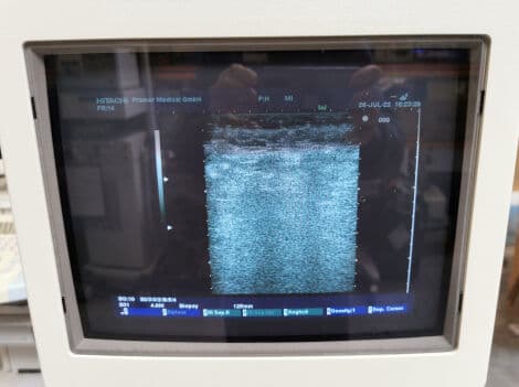 Hitachi EUP-B31 Biopsy Ultrasound Transducer thumbnail 2