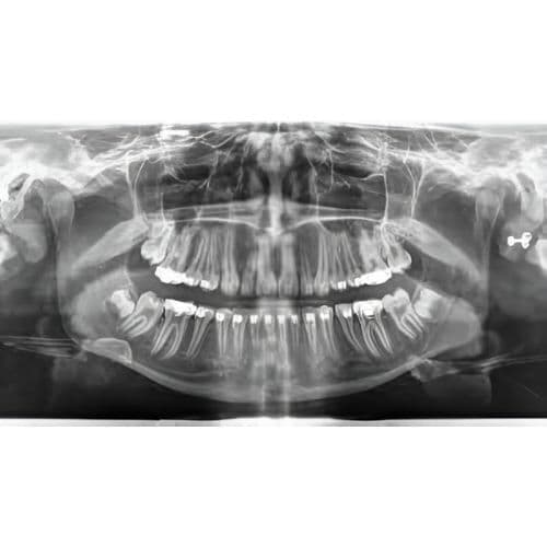 Sirona Orthophos XG Pan + Ceph Dental X-Ray System thumbnail 5