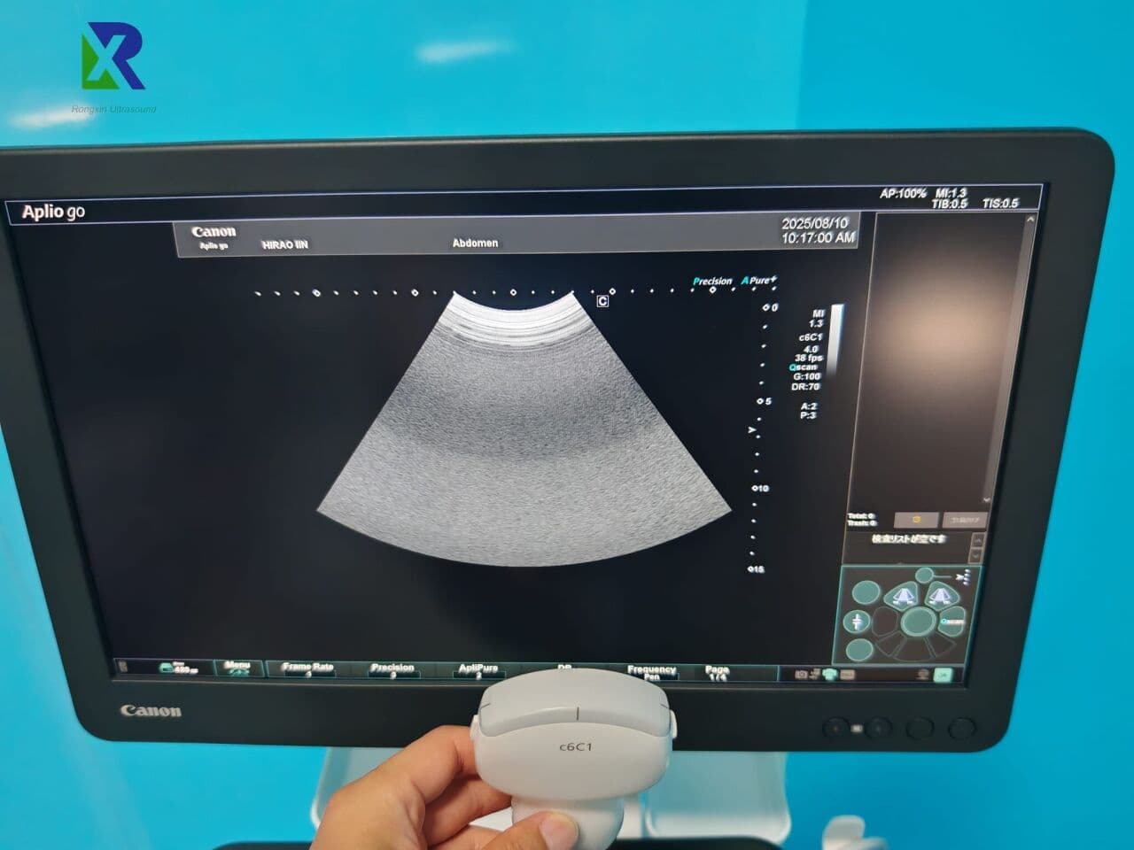Toshiba Aplio Go Compact Ultrasound System thumbnail 3