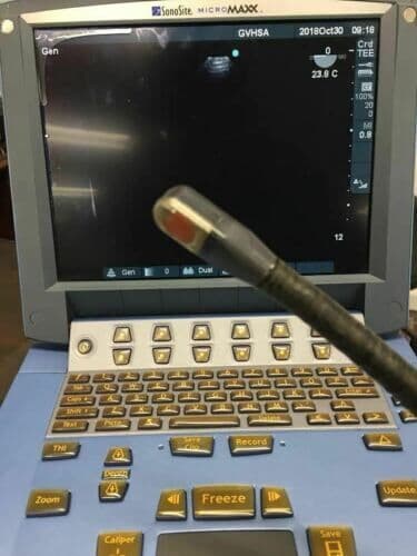 Sonosite MicroMaxx Portable Ultrasound System thumbnail 6