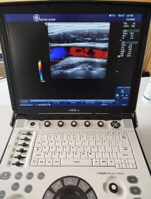 GE Logiq E Portable Ultrasound System thumbnail 10