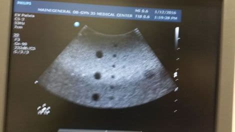 Philips C5-2 Curved Array Ultrasound Transducer thumbnail 2