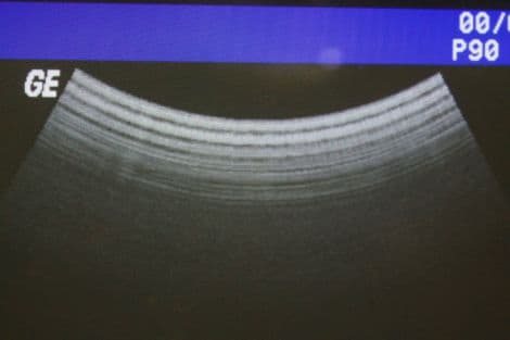 GE C358 Convex Ultrasound Transducer for Abdominal, Urology, and OB-GYN thumbnail 3