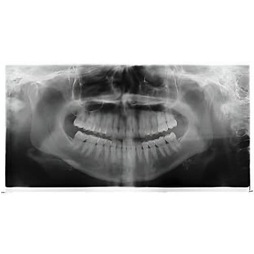 Sirona Orthophos XG Pan + Ceph Dental X-Ray System thumbnail 4