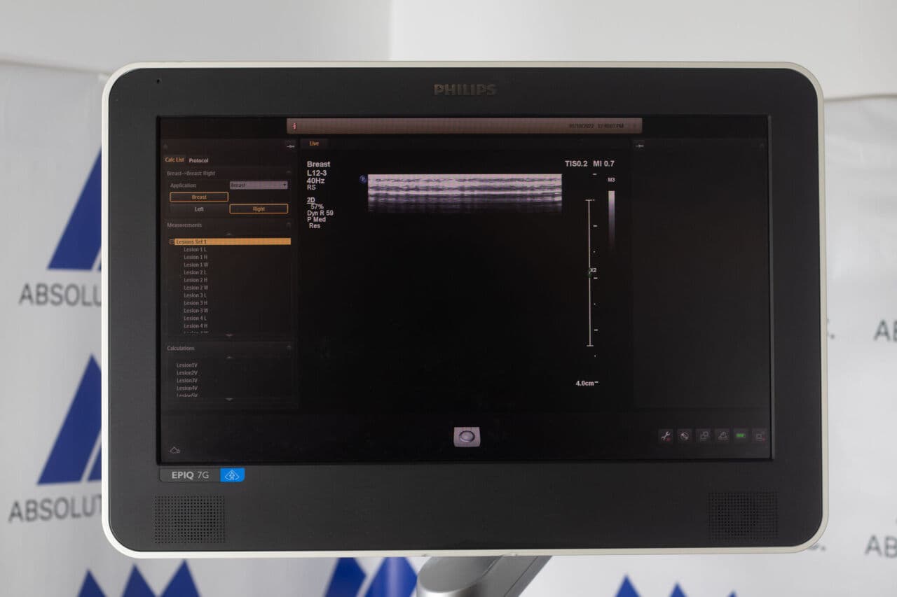 Philips Epiq 7G Ultrasound System thumbnail 4