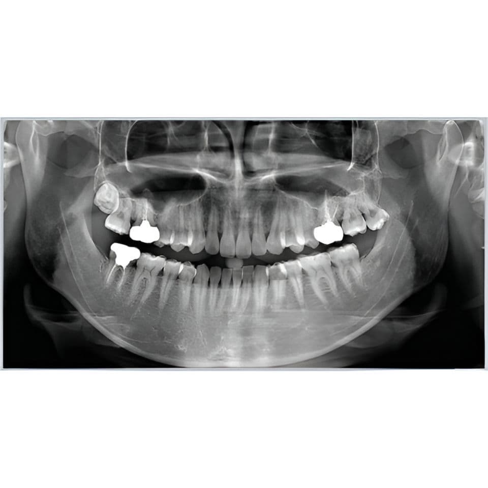 RAYSCAN Alpha Pan + CBCT (10x10 FOV) 3D Dental X-Ray System thumbnail 7