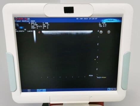 General Ultrasound System by Esaote — Mylab 60 with LA435, LA522E, and CA631 Probes thumbnail 5