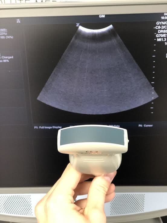 ZONARE C6-2 Convex Ultrasound Transducer Probe thumbnail 2