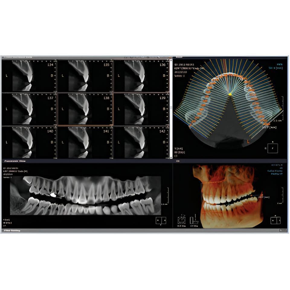 RAYSCAN Alpha Pan + CBCT (10x10 FOV) 3D Dental X-Ray System thumbnail 4