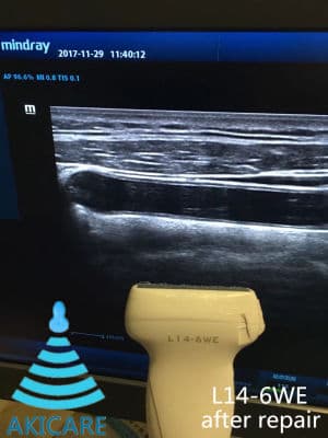 AKICARE L14-6WE Ultrasound Transducer for Mindray Systems