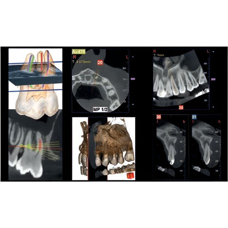 MyRay Hyperion X9 PRO Pan/Ceph/CBCT Dental X-Ray with 13x16 FOV thumbnail 3