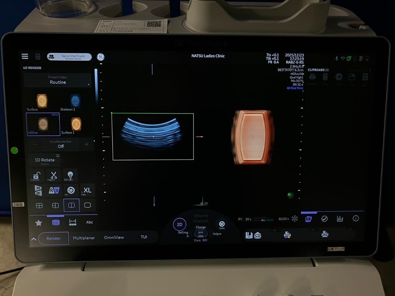 Advanced 4D GE Voluson Swift BT23 OB/GYN Ultrasound System thumbnail 3