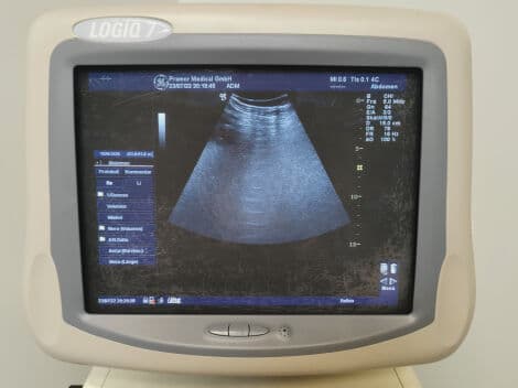 GE Logiq 7 Cardiac Ultrasound System thumbnail 8