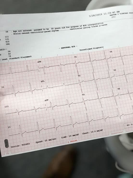 Philips PageWriter TC50 Diagnostic EKG thumbnail 6