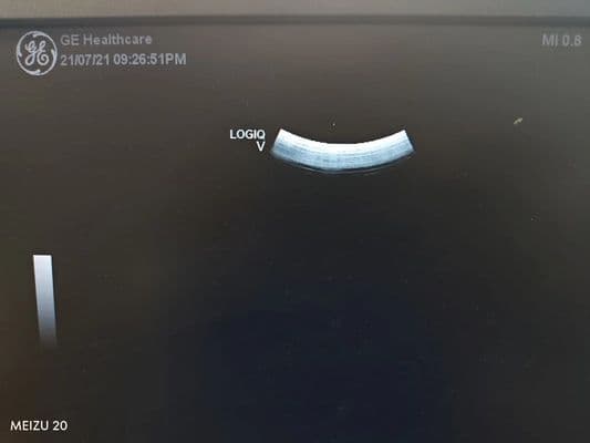 GE 4C-RS Ultrasound Transducer thumbnail 4