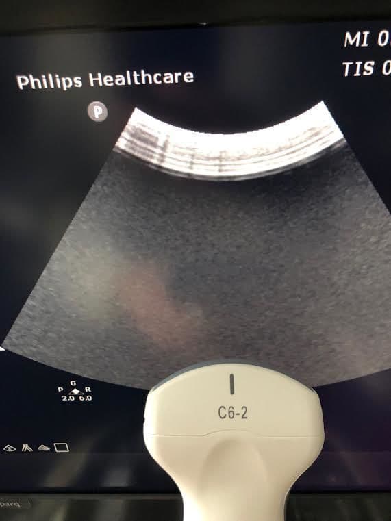 Philips C6-2 Curved Array Ultrasound Transducer image 1