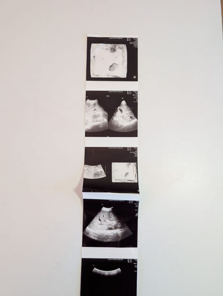 GE EM6C 4D Convex Ultrasound Transducer thumbnail 6