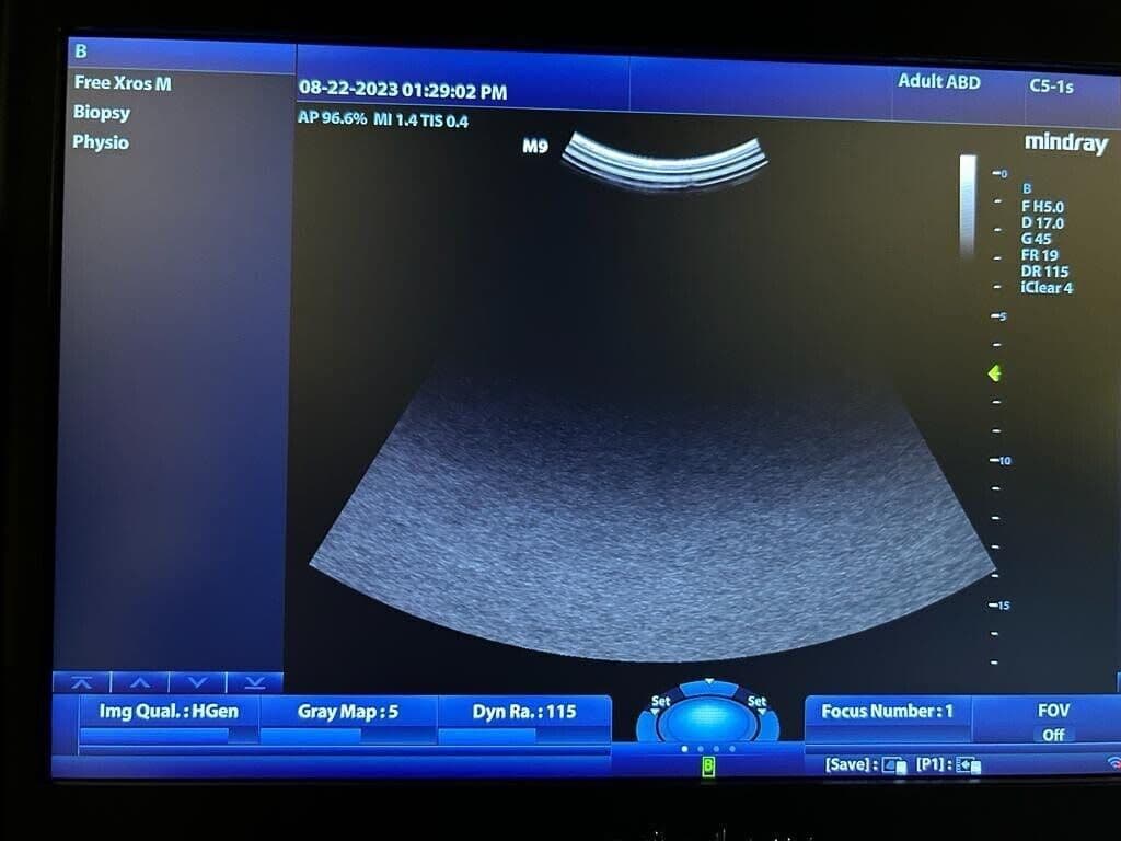 Mindray C5-1 Curved Array Ultrasound Transducer thumbnail 4