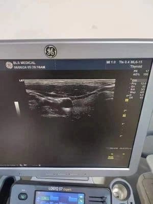 GE ML6-15 Linear Array Ultrasound Transducer thumbnail 3