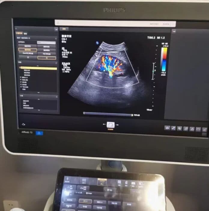 Philips Epiq 5 / Epiq 7 Ultrasound Machine LCD Monitor - 453561700442 thumbnail 2