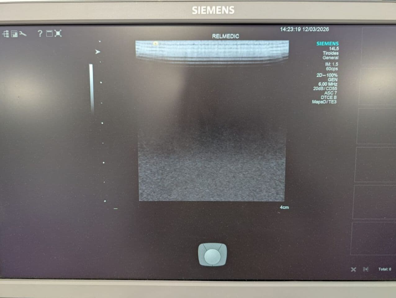 Siemens 14L5 Linear Ultrasound Transducer thumbnail 7