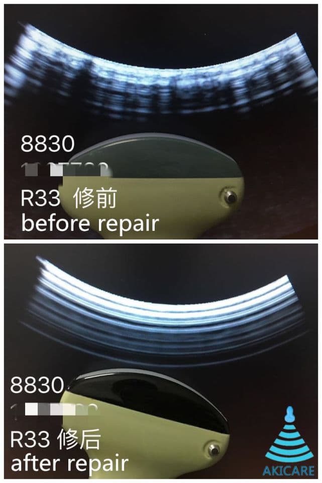 AKICARE 8830 Ultrasound Transducer for BK Systems