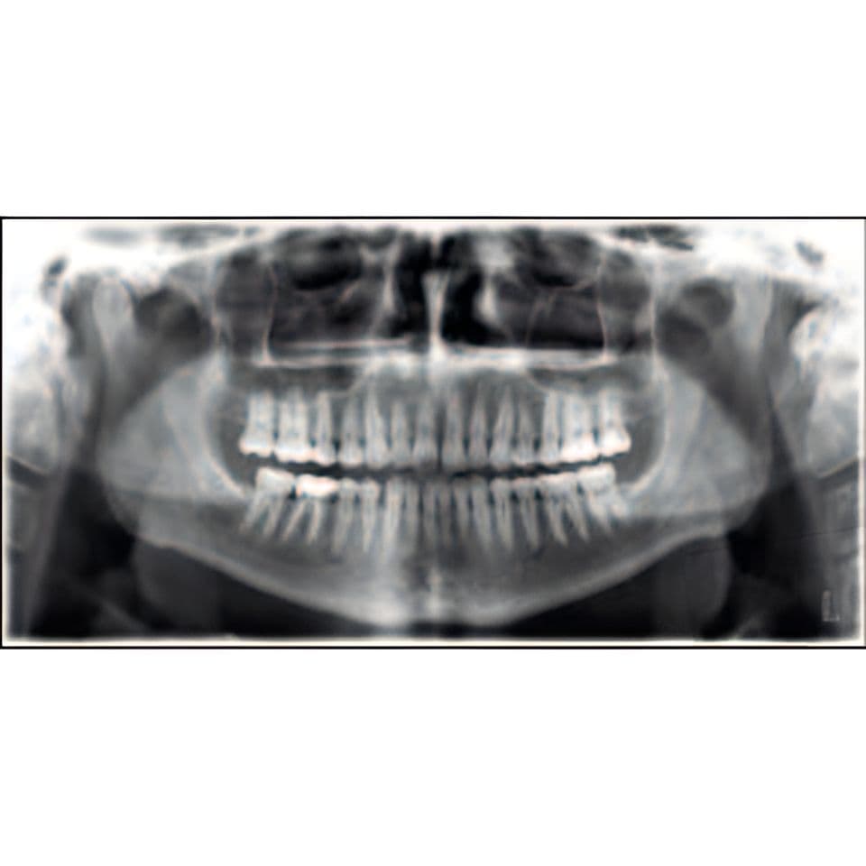 Planmeca ProMax Pan Dental X-Ray System thumbnail 4