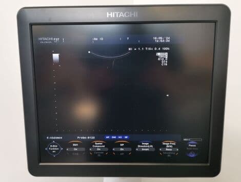Hitachi Aloka F-37 Ultrasound System with UST-9123, UST-568, and UST-9124 Probes thumbnail 7