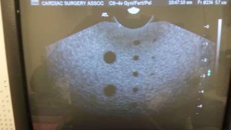 ATL C8-4v Endovaginal Curved Array Ultrasound Transducer thumbnail 3