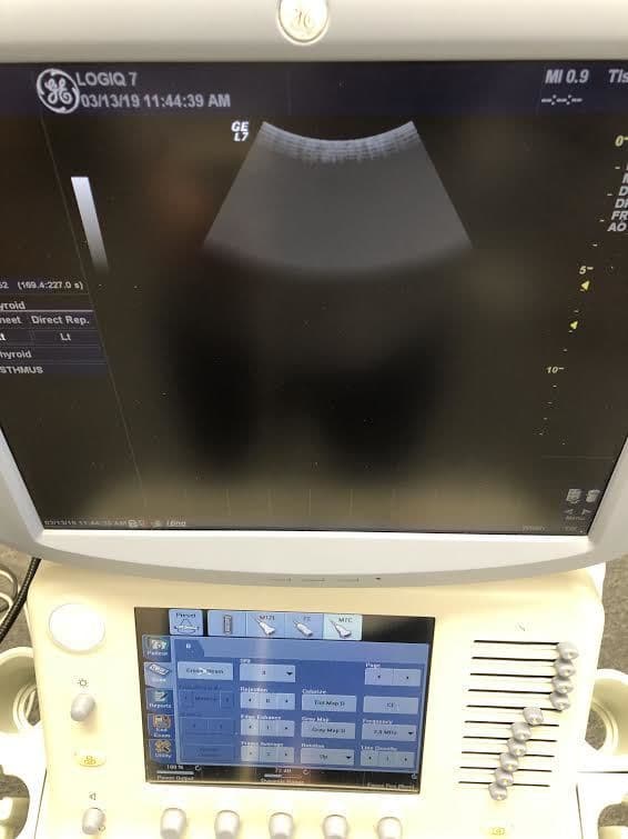 GE M7C Convex Ultrasound Transducer Probe thumbnail 4