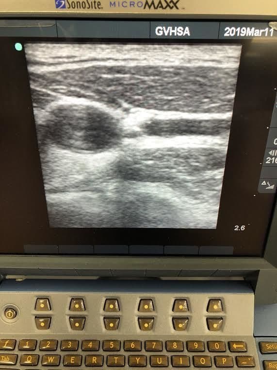Sonosite L25e Linear Ultrasound Transducer Probe thumbnail 2