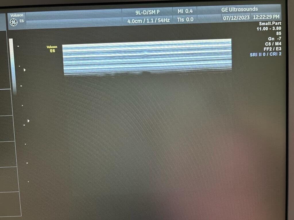 GE 9L-D Linear Array Ultrasound Transducer thumbnail 3