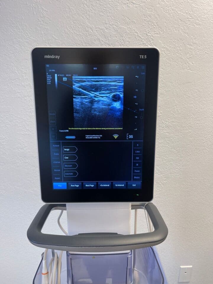 Mindray TE5 Musculoskeletal Ultrasound System thumbnail 2