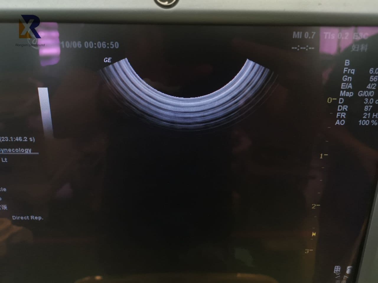 GE E8C Endocavity Ultrasound Transducer Probe thumbnail 4