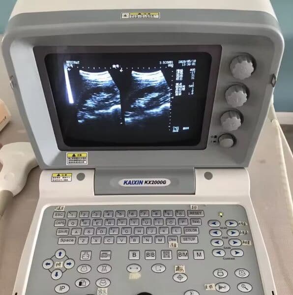Kretz Kaixin KX2000g Ultrasound System with Convex Probe image 1
