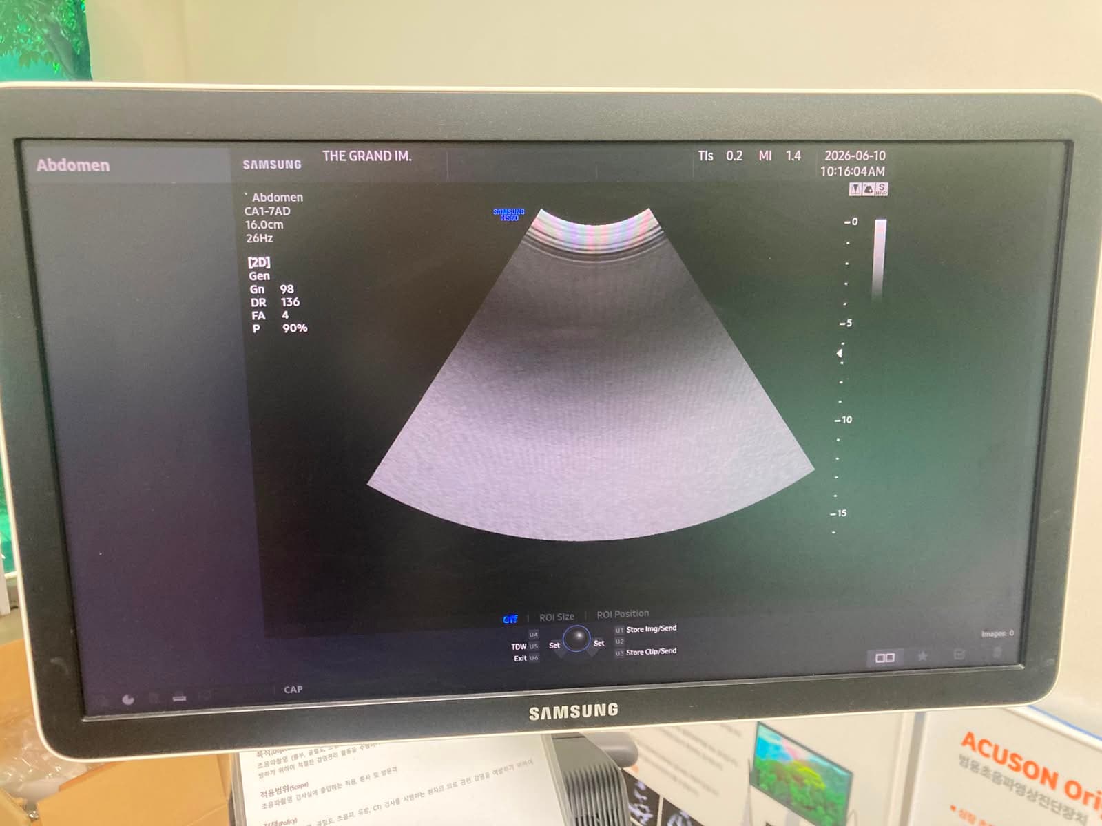 Samsung Medison HS60 Premium Ultrasound System with LA3-14AD PA1-5A CA1-7AD Probes Excellent Condition thumbnail 6