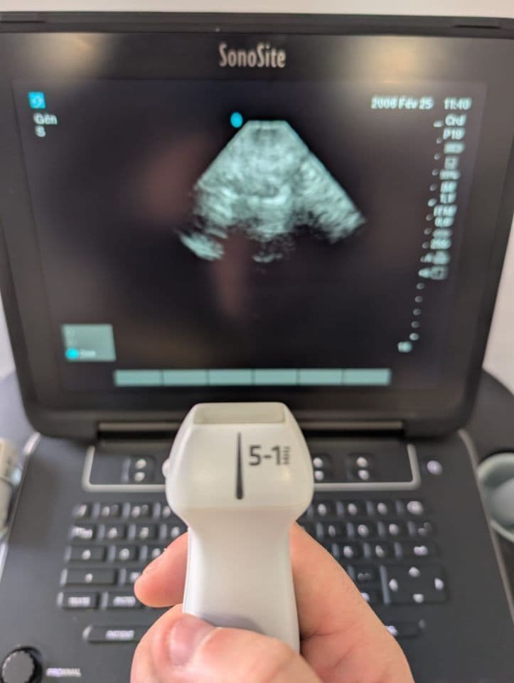 Sonosite rP19x Cardiac Ultrasound Transducer Probe thumbnail 10