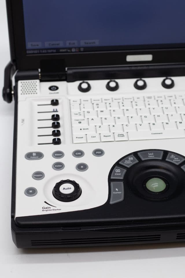 GE Logiq E Portable Shared Service Ultrasound System thumbnail 7